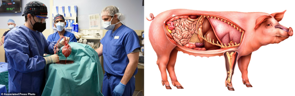 PHOTOS::::US SURGEONS TRANSPLANT A PIG HEART INTO A HUMAN IN MEDICAL BREAKTHROUGH FIRST: DYING MARYLAND HANDYMAN, 57, WHO’S INELIGIBLE FOR A HUMAN ORGAN IS ‘DOING WELL’ THREE DAYS AFTER RISKY ‘LAST DITCH’ PROCEDURE